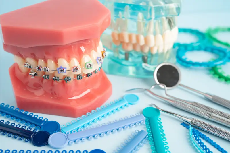 Basics in Orthodontics